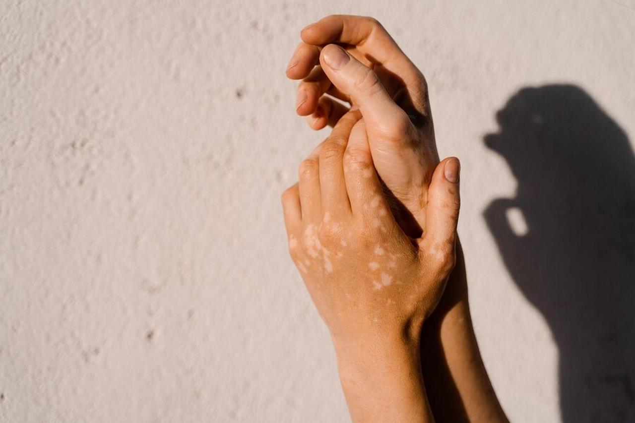 Starzejąca się skóra dłoni - jak leczyć